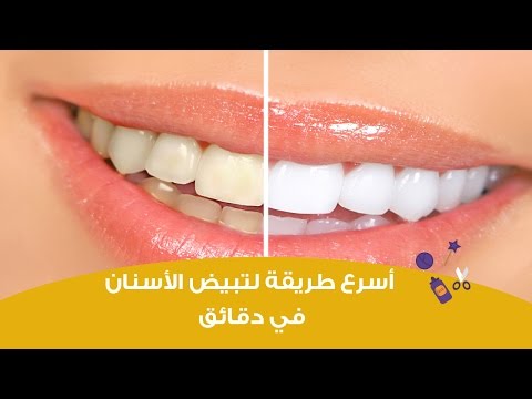 أسرع طريقة لتبيض الأسنان