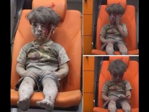 شاهد مأساة الطفل عُمران وصوره تهز العالم