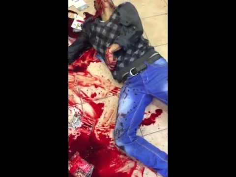 مستوطن صهيوني يطعن شاب فلسطيني