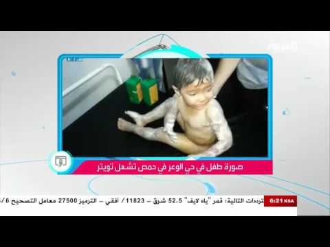 طفل حي الوعر السوري ومأساة جديدة