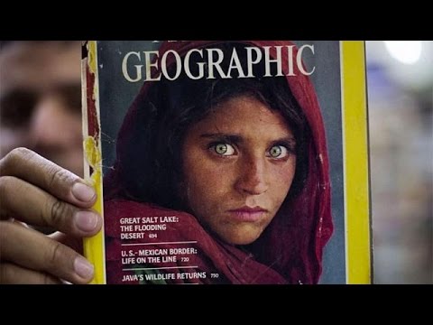 شاهد شربات غولا تتلقى العلاج في مستشفى باكستاني