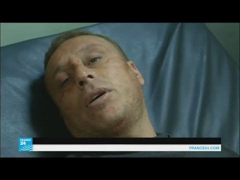 تفاصيل يرويها مصابون في تفجيرات كوكجلي