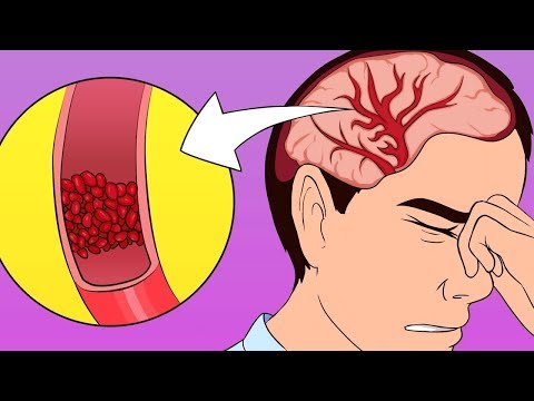 شاهد طريقة علمية لعلاج الصداع بدون الحبوب أو المسكنات