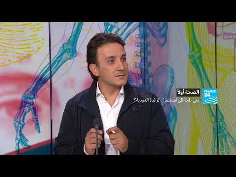 طبيب يكشف حالات اللجوء إلى استئصال الزائدة الدودية