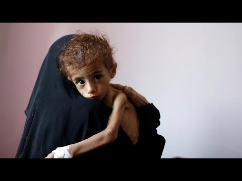 الأمم المتحدة تُحذر من مجاعة وشيكة ستضرب في اليمن