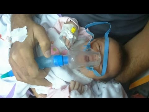 شاهد وفاة رضيعة سورية بغازات داعش الكيميائية