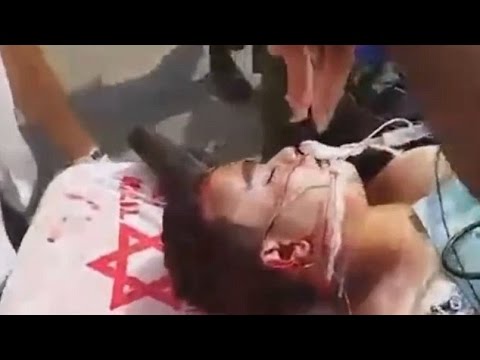 بالفيديو إسرائيلي يضع لحم الخنزير على وجه شهيد فلسطيني