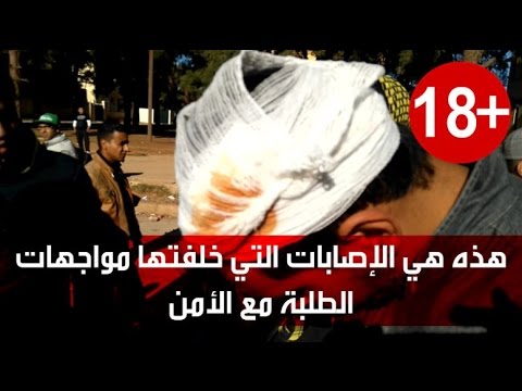 نتائج المواجهات بين الطلبة والأمن في فاس