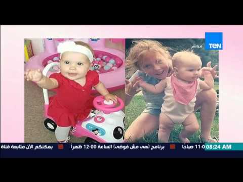 أطراف صناعية تعيد الأمل لطفلة مصابة بـ الالتهاب السحائي